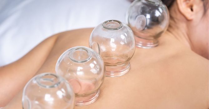 Back Massage, Warm Pads and Cupping